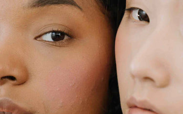 Woman treating spot with cotton pad