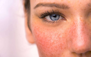 Woman with red cheeks and blue eyes looking into the camera